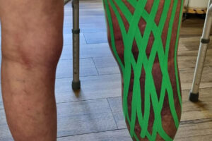 kinesiotaping Zielona Góra